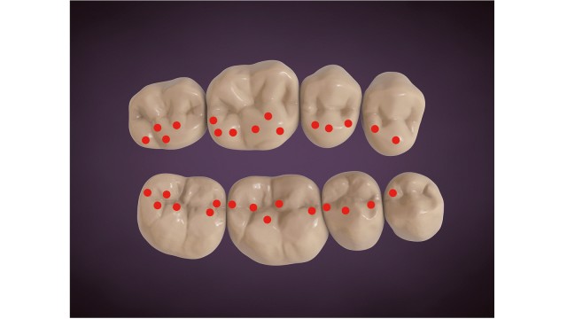 Modello occlusione 03