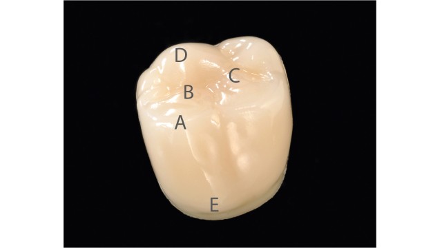 Dente posteriore